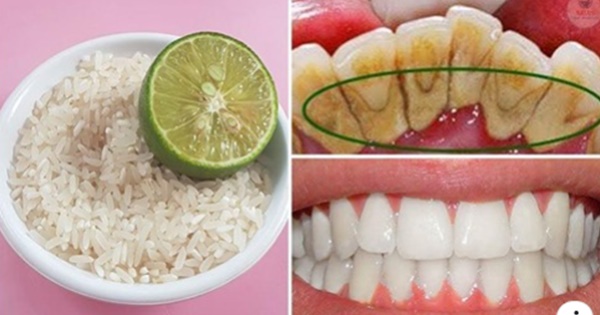 dientes (3)