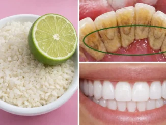 blanquear dientes casa bicarbonato — limón, dientes manchados y dientes blancos