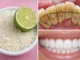 blanquear dientes casa bicarbonato — limón, dientes manchados y dientes blancos