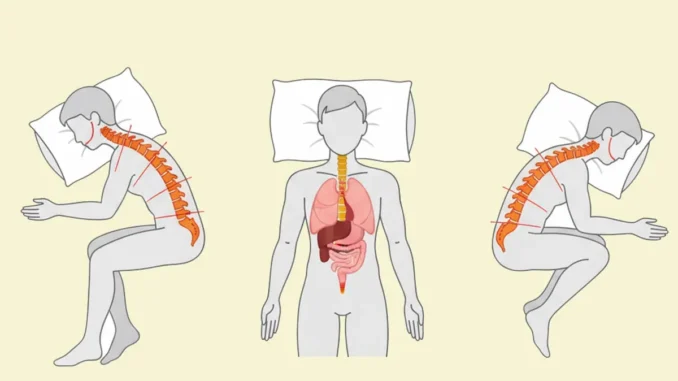 Ilustración médica comparando la alineación de la columna vertebral y los órganos en las posturas al dormir: boca arriba, de lado y boca abajo.