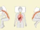 Ilustración médica comparando la alineación de la columna vertebral y los órganos en las posturas al dormir: boca arriba, de lado y boca abajo.