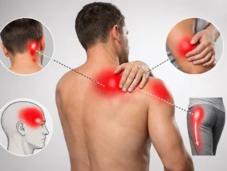 Diagrama de dolor referido muscular mostrando cómo un punto gatillo en el hombro refiere dolor a la nuca, la cabeza, el brazo y la pierna